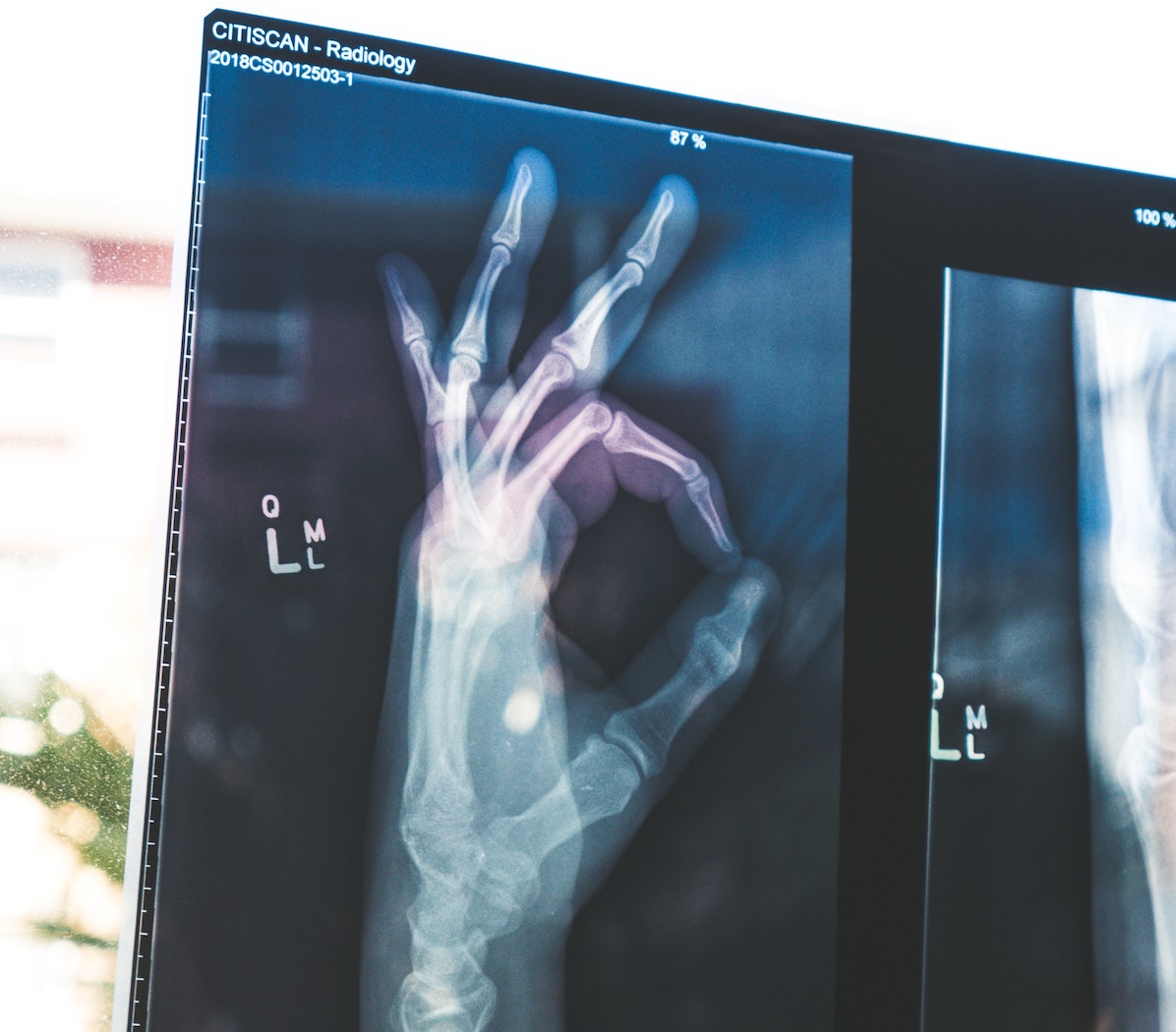 OK hand x-ray good patient reviews